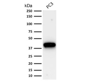 AMACR / P504S Antibody - Western blot testing of human PC-3 cell lysate with AMACR antibody. Predicted molecular weight ~43 kDa.