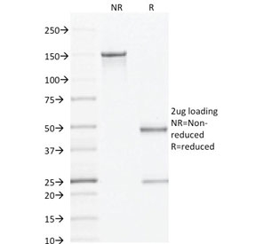 AMACR / P504S Antibody - SDS-PAGE analysis of purified, BSA-free AMACR antibody (clone AMACR/1864) as confirmation of integrity and purity.