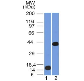 AMACR / P504S Antibody - Western blot testing of 1) human partial protein and 2) human kidney lysate with AMACR antibody. Predicted molecular weight ~43 kDa.