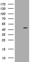 AMACR / P504S Antibody - HEK293T cells were transfected with the pCMV6-ENTRY control (Left lane) or pCMV6-ENTRY AMACR (Right lane) cDNA for 48 hrs and lysed. Equivalent amounts of cell lysates (5 ug per lane) were separated by SDS-PAGE and immunoblotted with anti-AMACR.