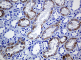 AMACR / P504S Antibody - IHC of paraffin-embedded Human Kidney tissue using anti-AMACR mouse monoclonal antibody.