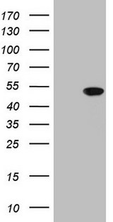AMACR / P504S Antibody - HEK293T cells were transfected with the pCMV6-ENTRY control. (Left lane) or pCMV6-ENTRY AMACR. (Right lane) cDNA for 48 hrs and lysed. Equivalent amounts of cell lysates. (5 ug per lane) were separated by SDS-PAGE and immunoblotted with anti-AMACR.