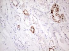 AMACR / P504S Antibody - Immunohistochemical staining of paraffin-embedded Human Kidney tissue within the normal limits using anti-AMACR mouse monoclonal antibody. (Heat-induced epitope retrieval by 1mM EDTA in 10mM Tris buffer. (pH8.5) at 120°C for 3 min. (1:150)