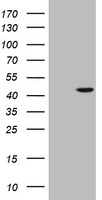 AMACR / P504S Antibody - HEK293T cells were transfected with the pCMV6-ENTRY control (Left lane) or pCMV6-ENTRY AMACR (Right lane) cDNA for 48 hrs and lysed. Equivalent amounts of cell lysates (5 ug per lane) were separated by SDS-PAGE and immunoblotted with anti-AMACR.