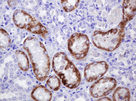 AMACR / P504S Antibody - IHC of paraffin-embedded Human Kidney tissue using anti-AMACR mouse monoclonal antibody.