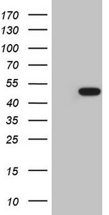 AMACR / P504S Antibody - HEK293T cells were transfected with the pCMV6-ENTRY control. (Left lane) or pCMV6-ENTRY AMACR. (Right lane) cDNA for 48 hrs and lysed. Equivalent amounts of cell lysates. (5 ug per lane) were separated by SDS-PAGE and immunoblotted with anti-AMACR. (1:2000)