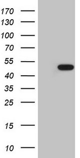 AMACR / P504S Antibody - HEK293T cells were transfected with the pCMV6-ENTRY control. (Left lane) or pCMV6-ENTRY AMACR. (Right lane) cDNA for 48 hrs and lysed