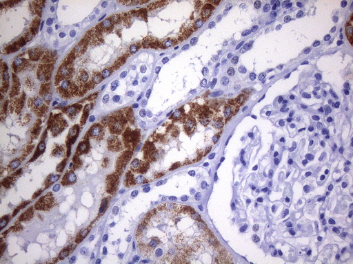 AMACR / P504S Antibody - Immunohistochemical staining of paraffin-embedded human kidney tissue within the normal limits using anti-AMACR mouse monoclonal antibody. HIER pretreatment was done with 1mM EDTA in 10mM Tris buffer. (pH8.0) at 120°C for 2.5 minutes.was diluted 1:2400 and detection was done with HRP secondary and DAB chromogen. Strong cytoplasmic and membraneous stain was seen in >50% of the kidney tubules no stain was seen in glomeruli.