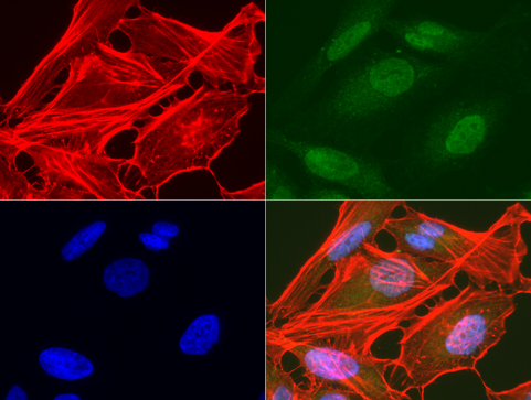 AMACR / P504S Antibody - Immunofluorescent staining of HeLa cells using anti-AMACR mouse monoclonal antibody  green, 1:50). Actin filaments were labeled with Alexa Fluor® 594 Phalloidin. (red), and nuclear with DAPI. (blue).