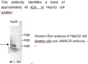 AMACR / P504S Antibody