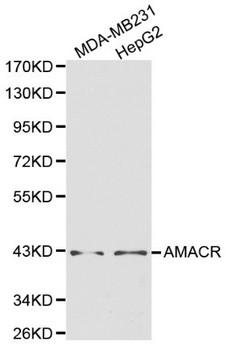AMACR / P504S Antibody - Western blot of AMACR pAb in extracts from MDA-MB231 and HepG2 cells.