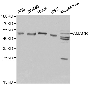 AMACR / P504S Antibody - Western blot analysis of extracts of various cell lines, using AMACR antibody.