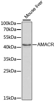 AMACR / P504S Antibody - Western blot analysis of extracts of mouse liver, using AMACR antibody at 1:1000 dilution. The secondary antibody used was an HRP Goat Anti-Rabbit IgG (H+L) at 1:10000 dilution. Lysates were loaded 25ug per lane and 3% nonfat dry milk in TBST was used for blocking. An ECL Kit was used for detection.