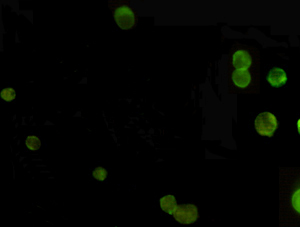 AMACR / P504S Antibody - Immunocytochemistry staining of Jurkat cells fixed with -20°C Ethanol and using anti-AMACR (C-terminus) mouse monoclonal antibody (dilution 1:100).