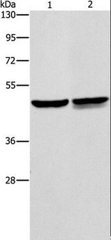 AMACR / P504S Antibody - Western blot analysis of A549 and Jurkat cell, using AMACR Polyclonal Antibody at dilution of 1:350.