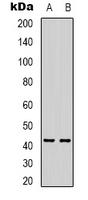AMACR / P504S Antibody - Western blot analysis of AMACR expression in HepG2 (A); mouse kidney (B) whole cell lysates.
