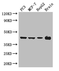 AMACR / P504S Antibody - Positive WB detected in:PC3 whole cell lysate,MCF-7 whole cell lysate,HepG2 whole cell lysate,Mouse brain tissue;All lanes: AMACR antibody at 3ug/ml;Secondary;Goat polyclonal to rabbit IgG at 1/50000 dilution;Predicted band size: 43,26,23,44 kDa;Observed band size: 43 kDa;