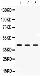 AMACR / P504S Antibody - Western blot - Anti-AMACR/P504S Picoband Antibody