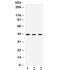 AMACR / P504S Antibody - Western blot testing of 1) rat kidney, 2) rat liver and 3) human HepG2 lysate with AMACR antibody at 0.5ug/ml. Predicted molecular weight ~43 kDa.