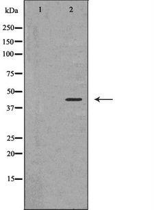 AMACR / P504S Antibody - Western blot analysis of HeLa whole cells lysates using AMACR antibody. The lane on the left is treated with the antigen-specific peptide.
