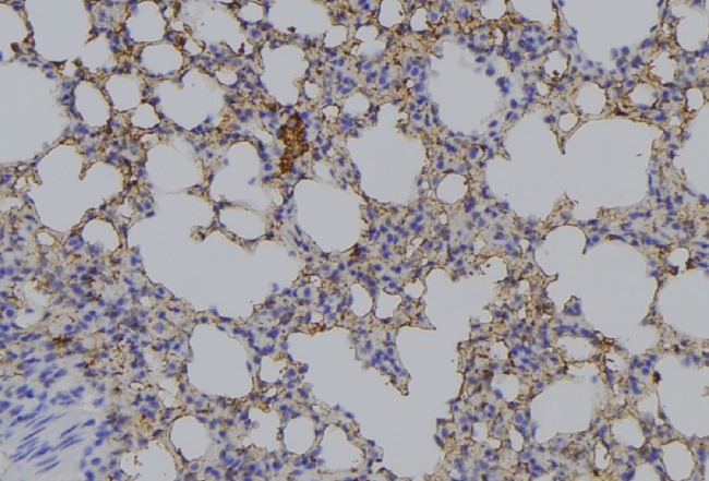 AMACR / P504S Antibody - 1:100 staining mouse lung tissue by IHC-P. The sample was formaldehyde fixed and a heat mediated antigen retrieval step in citrate buffer was performed. The sample was then blocked and incubated with the antibody for 1.5 hours at 22°C. An HRP conjugated goat anti-rabbit antibody was used as the secondary.
