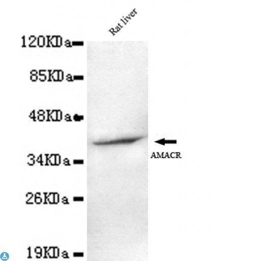 AMACR / P504S Antibody - Western blot detection of AMACR (C-term) in Rat Liver lysates using AMACR (C-term) mouse mAb (1:1000 diluted). Predicted band size: 42KDa. Observed band size: 42KDa.