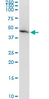 AMBP  Antibody - Western blot of expression in A-431cell lysate.