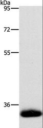 AMBP  Antibody - Western blot analysis of Human testis tissue, using AMBP Polyclonal Antibody at dilution of 1:500.