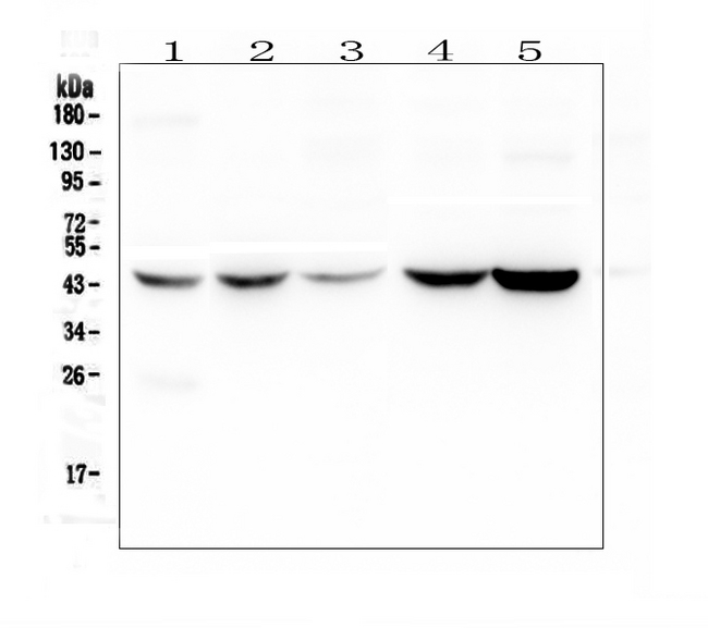 AMBP  Antibody - Western blot analysis of Alpha 1 microglobulin using anti-Alpha 1 microglobulin antibody. Electrophoresis was performed on a 5-20% SDS-PAGE gel at 70V (Stacking gel) / 90V (Resolving gel) for 2-3 hours. The sample well of each lane was loaded with 50ug of sample under reducing conditions. Lane 1: human placenta tissue lysates,Lane 2: human HEP-2 whole cell lysate,Lane 3: human Hela whole cell lysate,Lane 4: human A549 whole cell lysate,Lane 5: human PANC-1 whole cell lysate. After Electrophoresis, proteins were transferred to a Nitrocellulose membrane at 150mA for 50-90 minutes. Blocked the membrane with 5% Non-fat Milk/ TBS for 1.5 hour at RT. The membrane was incubated with rabbit anti-Alpha 1 microglobulin antigen affinity purified polyclonal antibody at 0.5 µg/mL overnight at 4°C, then washed with TBS-0.1% Tween 3 times with 5 minutes each and probed with a goat anti-rabbit IgG-HRP secondary antibody at a dilution of 1:10000 for 1.5 hour at RT. The signal is developed using an Enhanced Chemiluminescent detection (ECL) kit with Tanon 5200 system. A specific band was detected for Alpha 1 microglobulin at approximately 45KD. The expected band size for Alpha 1 microglobulin is at 39KD.