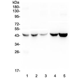 AMBP  Antibody - Western blot testing of human 1) placenta, 2) HEp-2, 3) HeLa, 4) A549 and 5) PANC-1 lysate with Alpha 1 microglobulin antibody at 0.5ug/ml. Predicted molecular weight: 26-28 kDa (Alpha 1 microglobulin), ~39 kDa (uncleaved AMBP). These proteins may be observed at higher molecular weights due to glycosylation.