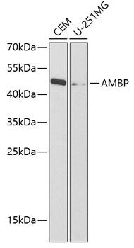 AMBP  Antibody - Western blot analysis of extracts of various cell lines using AMBP Polyclonal Antibody at dilution of 1:1000.
