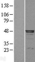 AMBP  Protein - Western validation with an anti-DDK antibody * L: Control HEK293 lysate R: Over-expression lysate
