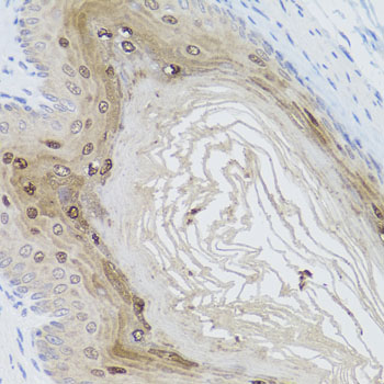 AMBRA1 Antibody - Immunohistochemistry of paraffin-embedded mouse stomach using AMBRA1 antibodyat dilution of 1:100 (40x lens).