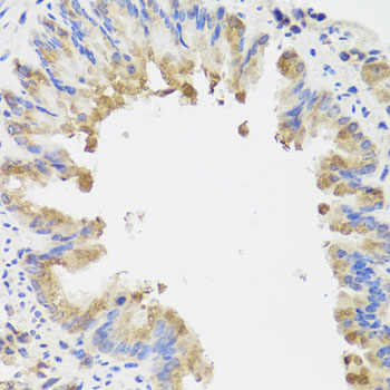AMBRA1 Antibody - Immunohistochemistry of paraffin-embedded mouse lung using AMBRA1 antibodyat dilution of 1:100 (40x lens).