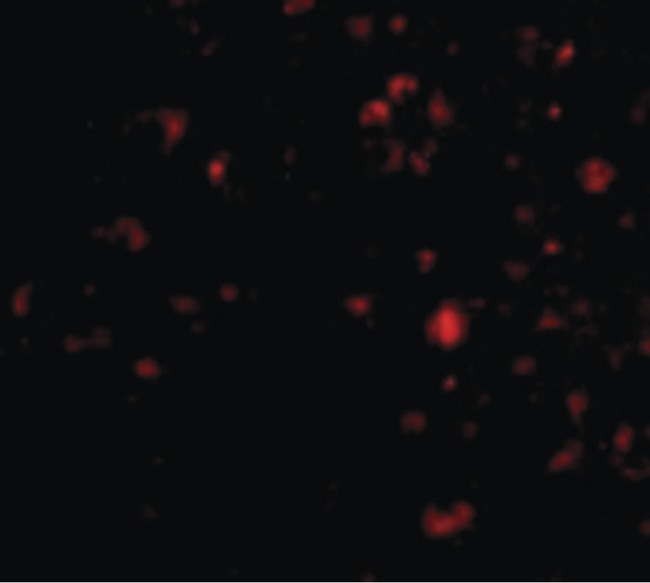 AMBRA1 Antibody - Immunofluorescence of Ambra1 in Human Brain cells with Ambra1 antibody at 20 ug/ml.