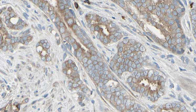AMBRA1 Antibody - 1:100 staining human prostate tissue by IHC-P. The sample was formaldehyde fixed and a heat mediated antigen retrieval step in citrate buffer was performed. The sample was then blocked and incubated with the antibody for 1.5 hours at 22°C. An HRP conjugated goat anti-rabbit antibody was used as the secondary.