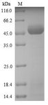 PLY5 / Pectate Lyase 5 Protein - (Tris-Glycine gel) Discontinuous SDS-PAGE (reduced) with 5% enrichment gel and 15% separation gel.