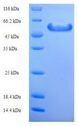 PLY5 / Pectate Lyase 5 Protein