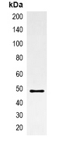 AmCyan Tag Antibody - Immunoprecipitation of AmCyan-tagged protein from HEK293T cells transfected with vector overexpressing AmCyan tag; using Anti-AmCyan-tag Antibody.