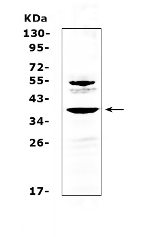 AMD / AMD1 Antibody - Western blot analysis of AMD1 using anti-AMD1 antibody. Electrophoresis was performed on a 5-20% SDS-PAGE gel at 70V (Stacking gel) / 90V (Resolving gel) for 2-3 hours. The sample well of each lane was loaded with 50ug of sample under reducing conditions. Lane 1: human 22RV1 whole cell lysates. After Electrophoresis, proteins were transferred to a Nitrocellulose membrane at 150mA for 50-90 minutes. Blocked the membrane with 5% Non-fat Milk/ TBS for 1.5 hour at RT. The membrane was incubated with rabbit anti-AMD1 antigen affinity purified polyclonal antibody at 0.5 ug/mL overnight at 4?, then washed with TBS-0.1% Tween 3 times with 5 minutes each and probed with a goat anti-rabbit IgG-HRP secondary antibody at a dilution of 1:10000 for 1.5 hour at RT. The signal is developed using an Enhanced Chemiluminescent detection (ECL) kit with Tanon 5200 system. A specific band was detected for AMD1 at approximately 38KD. The expected band size for AMD1 is at 38KD.