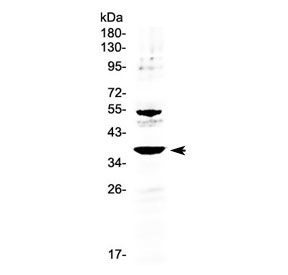 AMD / AMD1 Antibody - Western blot testing of human 22RV1 cell lysate with AMD1 antibody at 0.5ug/ml. Predicted molecular weight ~38 kDa.