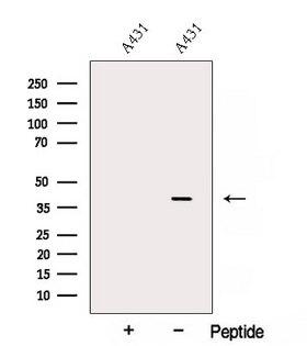 AMD / AMD1 Antibody - Western blot analysis of extracts of A431 cells using AMD1 antibody. The lane on the left was treated with blocking peptide.