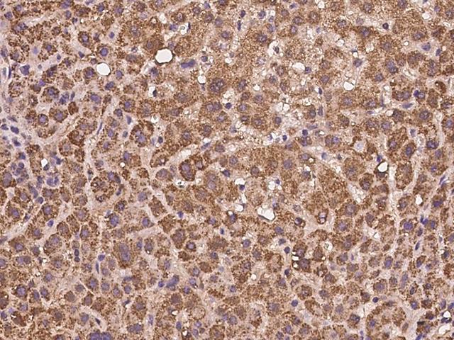 AMD / AMD1 Antibody - Immunochemical staining of human AMD1 in human liver with rabbit polyclonal antibody at 1:100 dilution, formalin-fixed paraffin embedded sections.