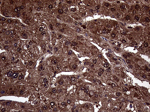 AMDHD1 Antibody - Immunohistochemical staining of paraffin-embedded Human liver tissue within the normal limits using anti-AMDHD1 mouse monoclonal antibody. (Heat-induced epitope retrieval by 1mM EDTA in 10mM Tris buffer. (pH8.5) at 120°C for 3 min. (1:500)