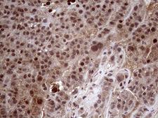 AMDHD1 Antibody - Immunohistochemical staining of paraffin-embedded Human liver tissue within the normal limits using anti-AMDHD1 mouse monoclonal antibody. (Heat-induced epitope retrieval by 1mM EDTA in 10mM Tris buffer. (pH8.5) at 120°C for 3 min. (1:2000)
