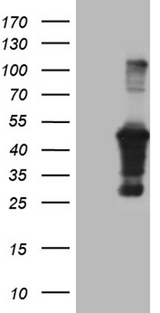 AMDHD1 Antibody - HEK293T cells were transfected with the pCMV6-ENTRY control. (Left lane) or pCMV6-ENTRY AMDHD1. (Right lane) cDNA for 48 hrs and lysed. Equivalent amounts of cell lysates. (5 ug per lane) were separated by SDS-PAGE and immunoblotted with anti-AMDHD1. (1:2000)