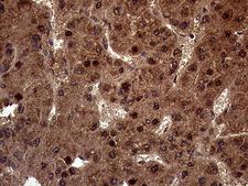AMDHD1 Antibody - Immunohistochemical staining of paraffin-embedded Human liver tissue within the normal limits using anti-AMDHD1 mouse monoclonal antibody. (Heat-induced epitope retrieval by 1mM EDTA in 10mM Tris buffer. (pH8.5) at 120°C for 3 min. (1:2000)