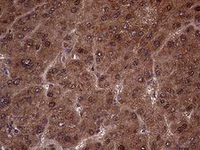 AMDHD1 Antibody - Immunohistochemical staining of paraffin-embedded Human liver tissue within the normal limits using anti-AMDHD1 mouse monoclonal antibody. (Heat-induced epitope retrieval by 1mM EDTA in 10mM Tris buffer. (pH8.5) at 120°C for 3 min. (1:1000)