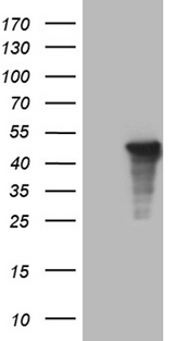 AMDHD1 Antibody - HEK293T cells were transfected with the pCMV6-ENTRY control. (Left lane) or pCMV6-ENTRY AMDHD1. (Right lane) cDNA for 48 hrs and lysed