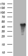 AMDHD1 Antibody - HEK293T cells were transfected with the pCMV6-ENTRY control. (Left lane) or pCMV6-ENTRY AMDHD1. (Right lane) cDNA for 48 hrs and lysed
